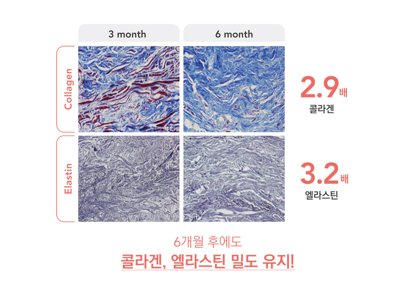 콜라겐 엘라스틴 밀도 변화