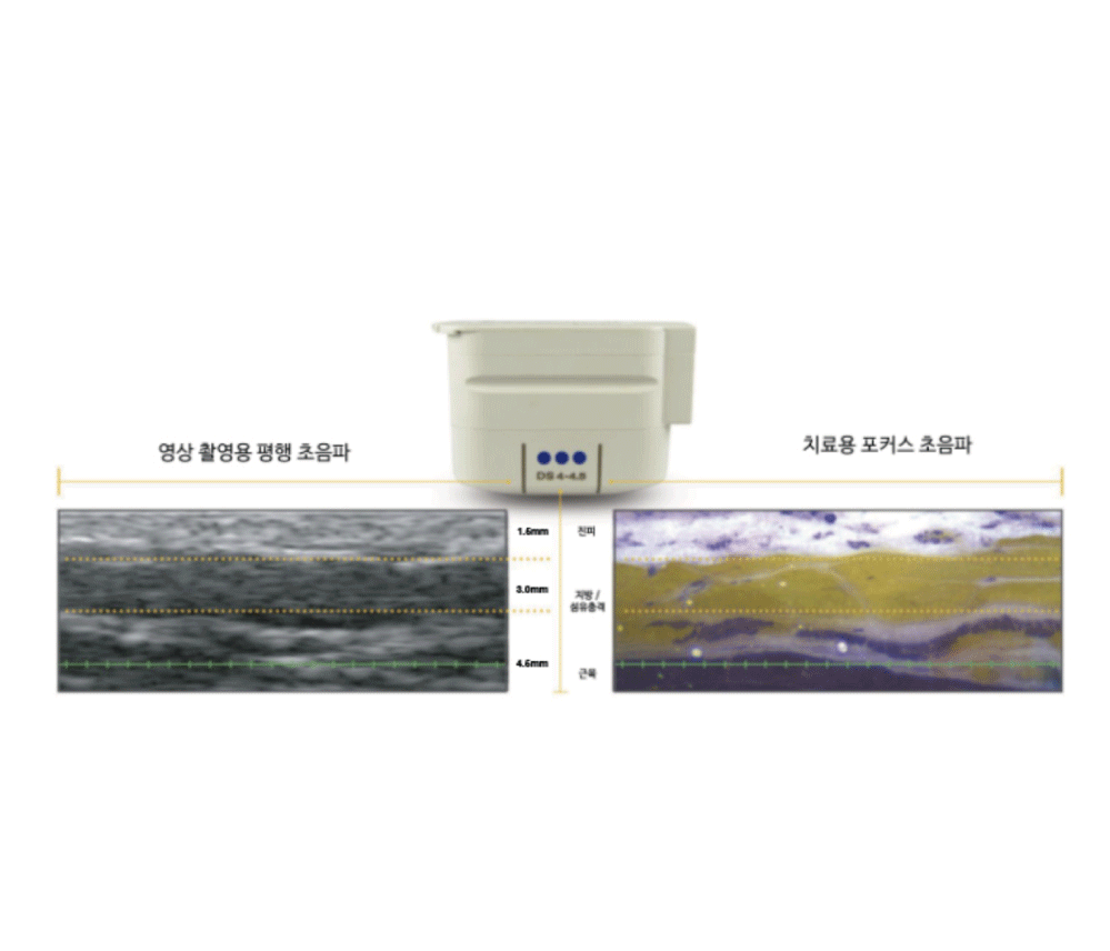 눈으로 직접보고 원하는 깊이에 정확하게