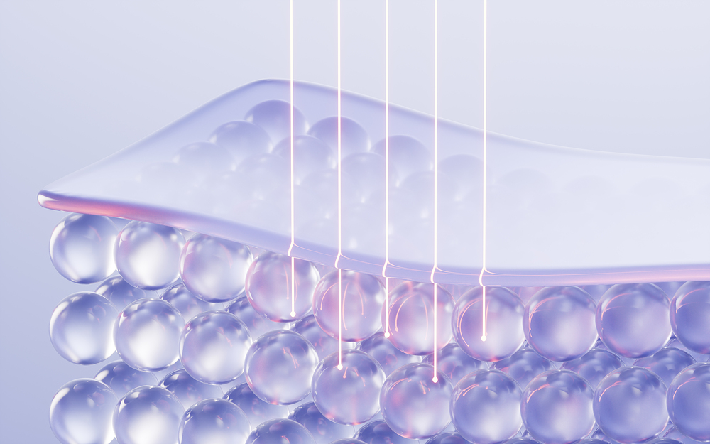 커스텀울써마지