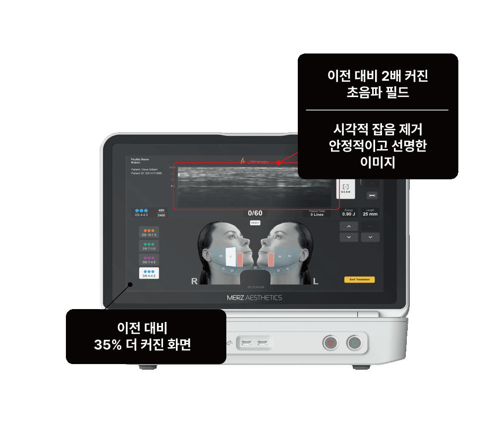 더 생생해진 시각화