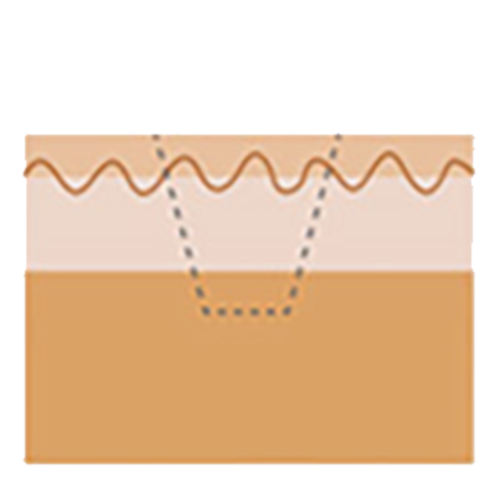 흉터 증상 개선