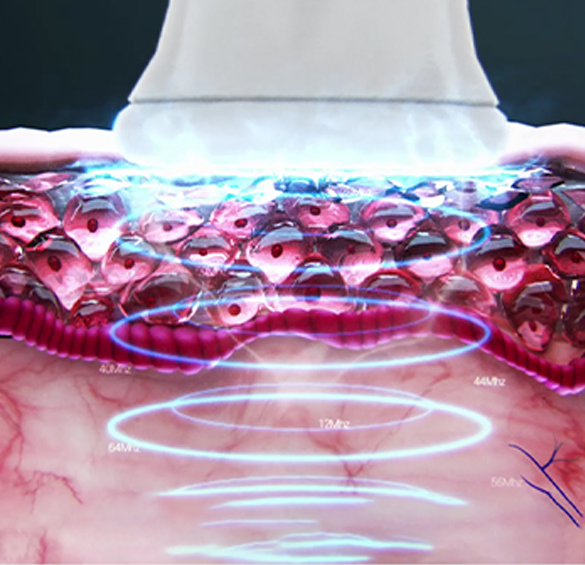 스킨 모노 핸드피스