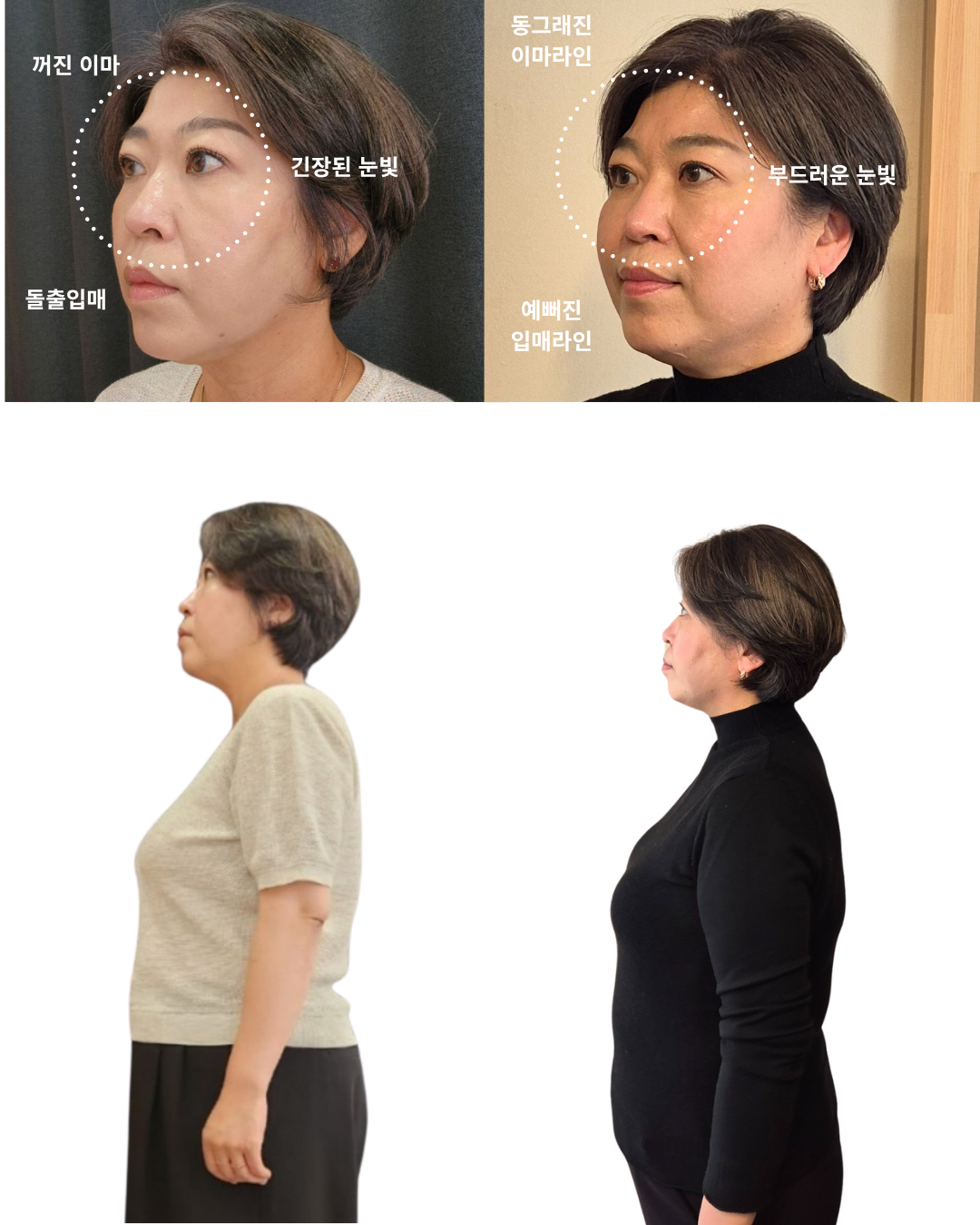 [ 시그니처 ] 두상호흡 풀 레슨