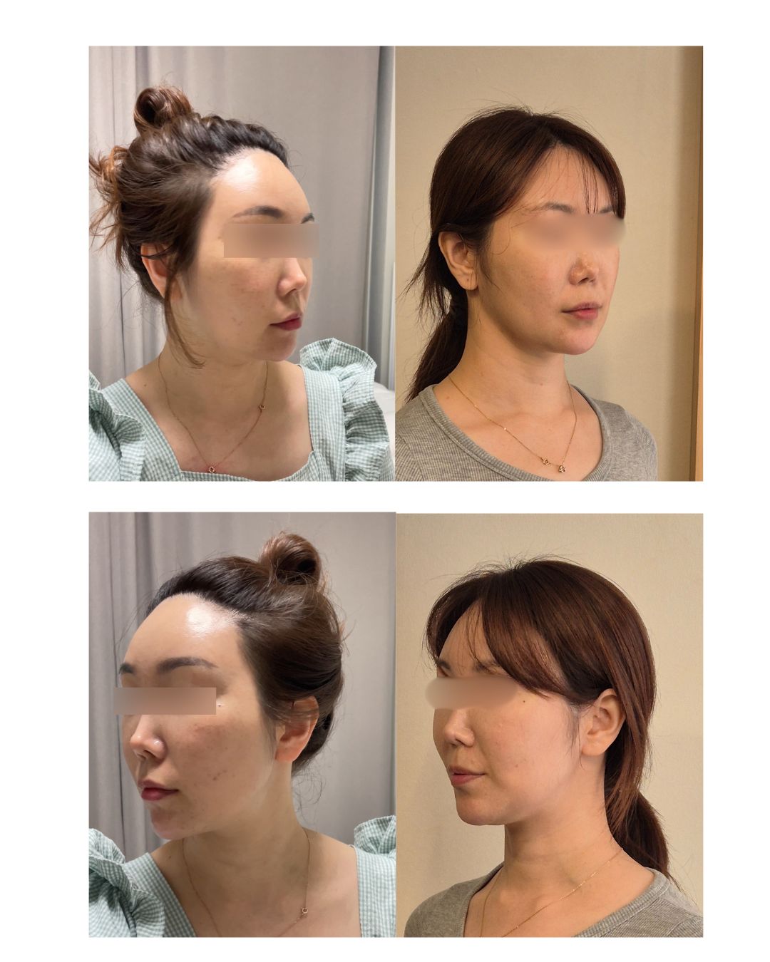 두상호흡 풀 레슨