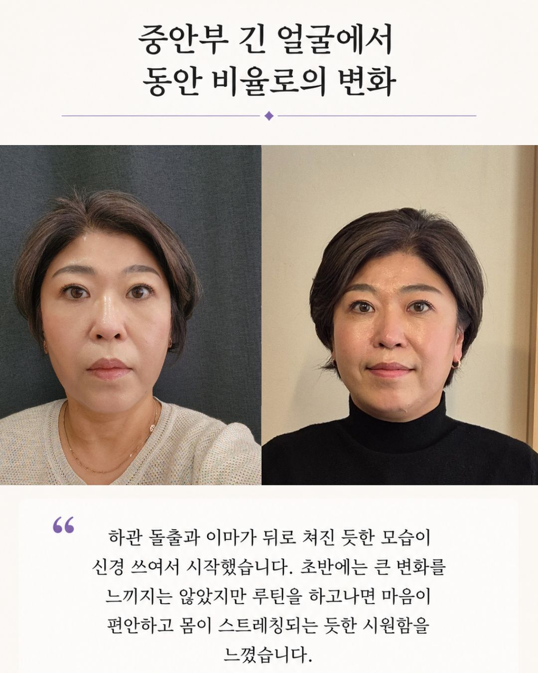 두상호흡 클래스｜원데이 클래스 + 올인원 프리미엄 (선택)