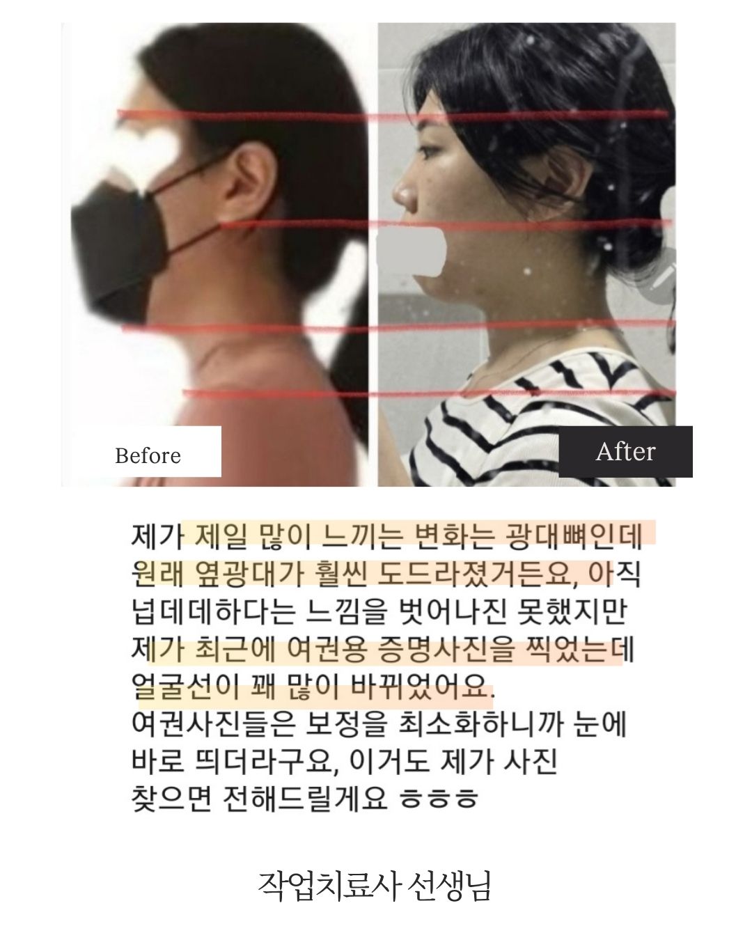 [ 옵션 ] 올인원 클래스 복제