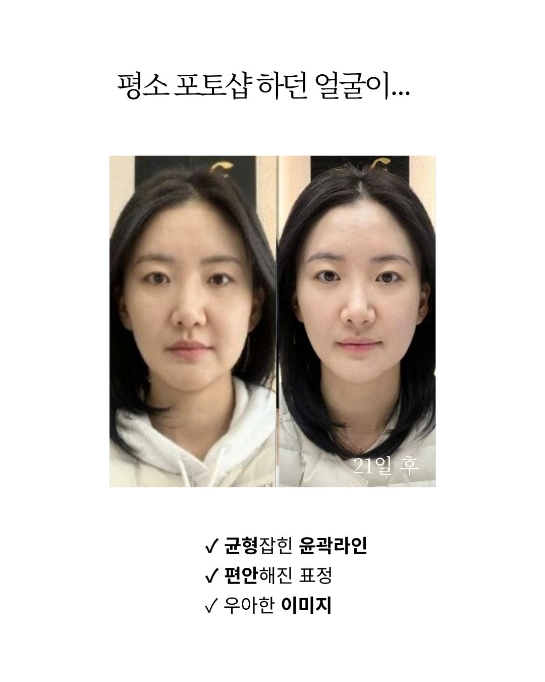 두상호흡 7스킬