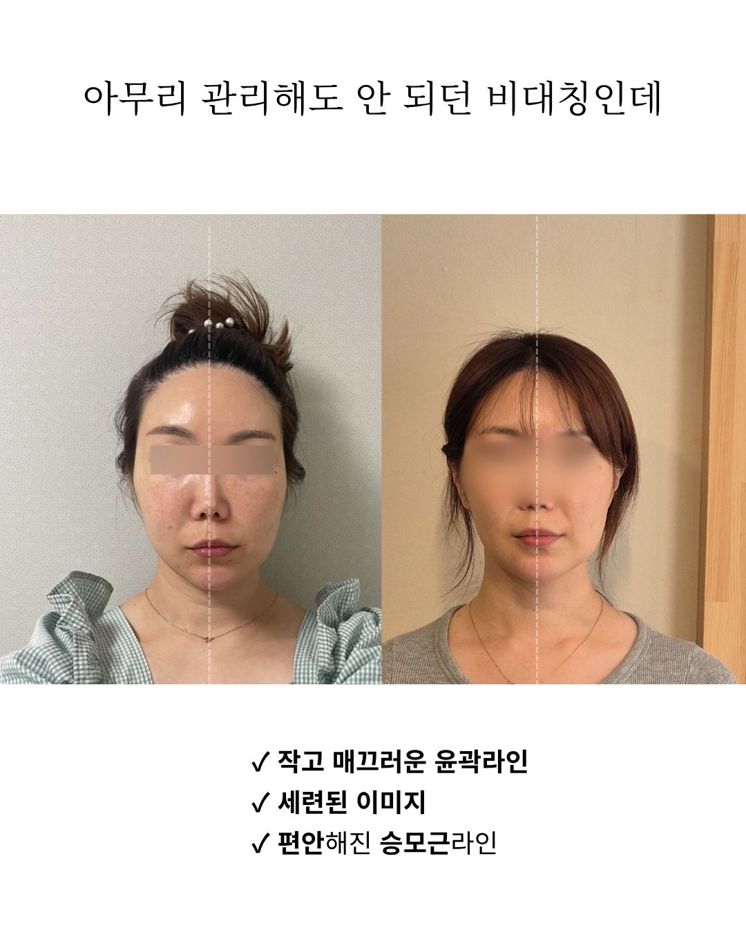 두상호흡 7스킬
