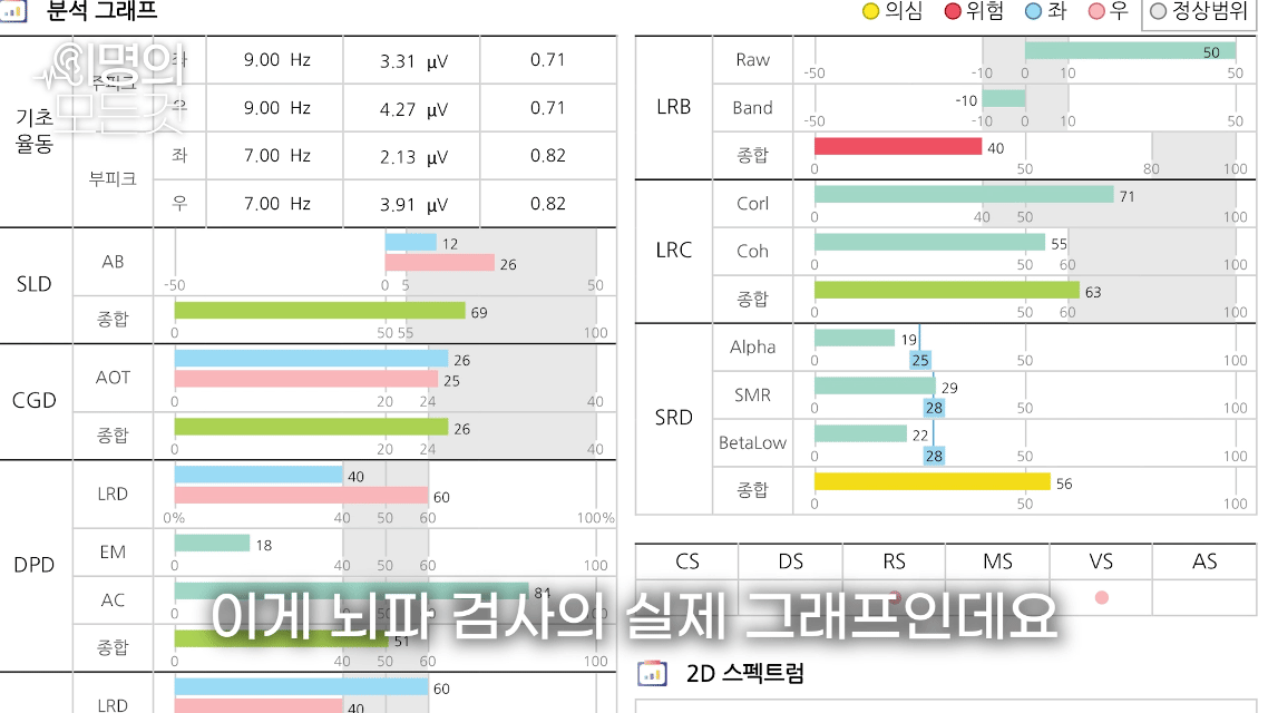 귀에서삐소리