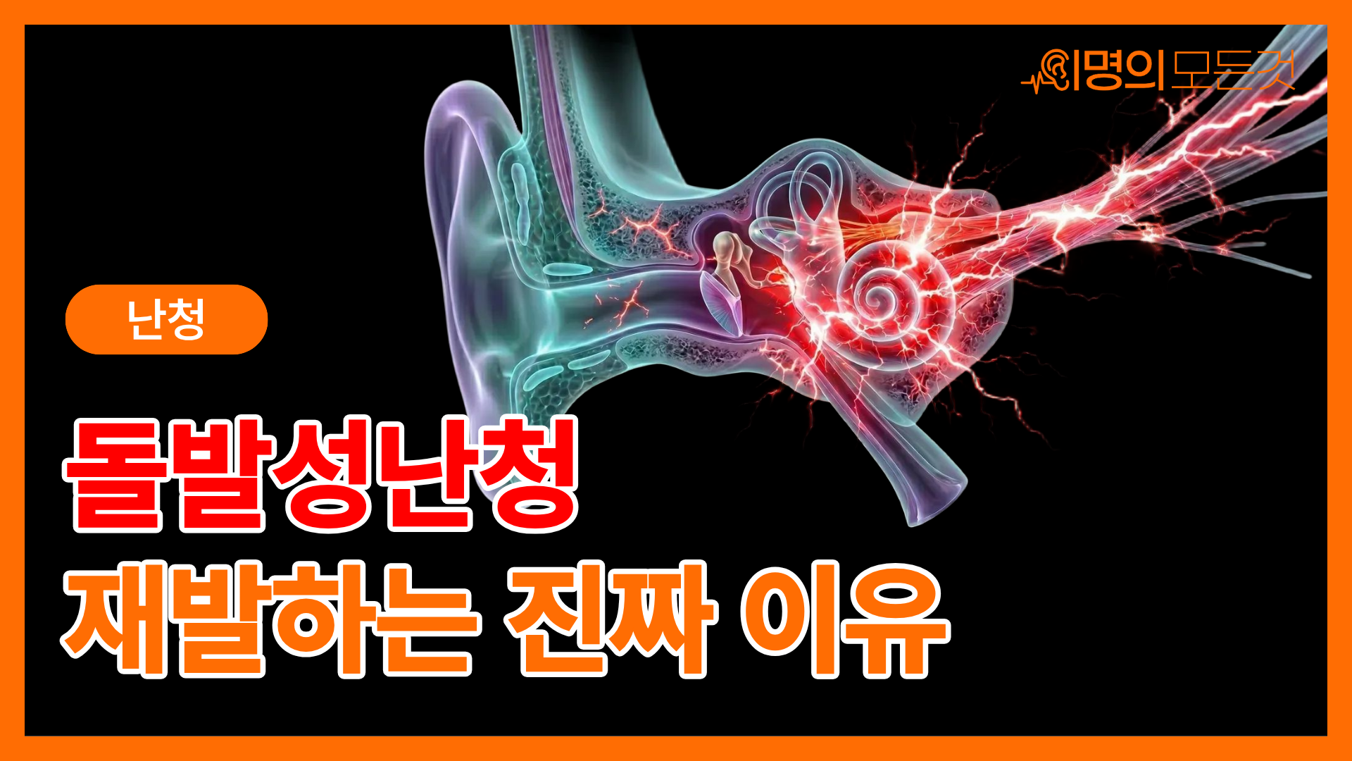 돌발성난청 치료