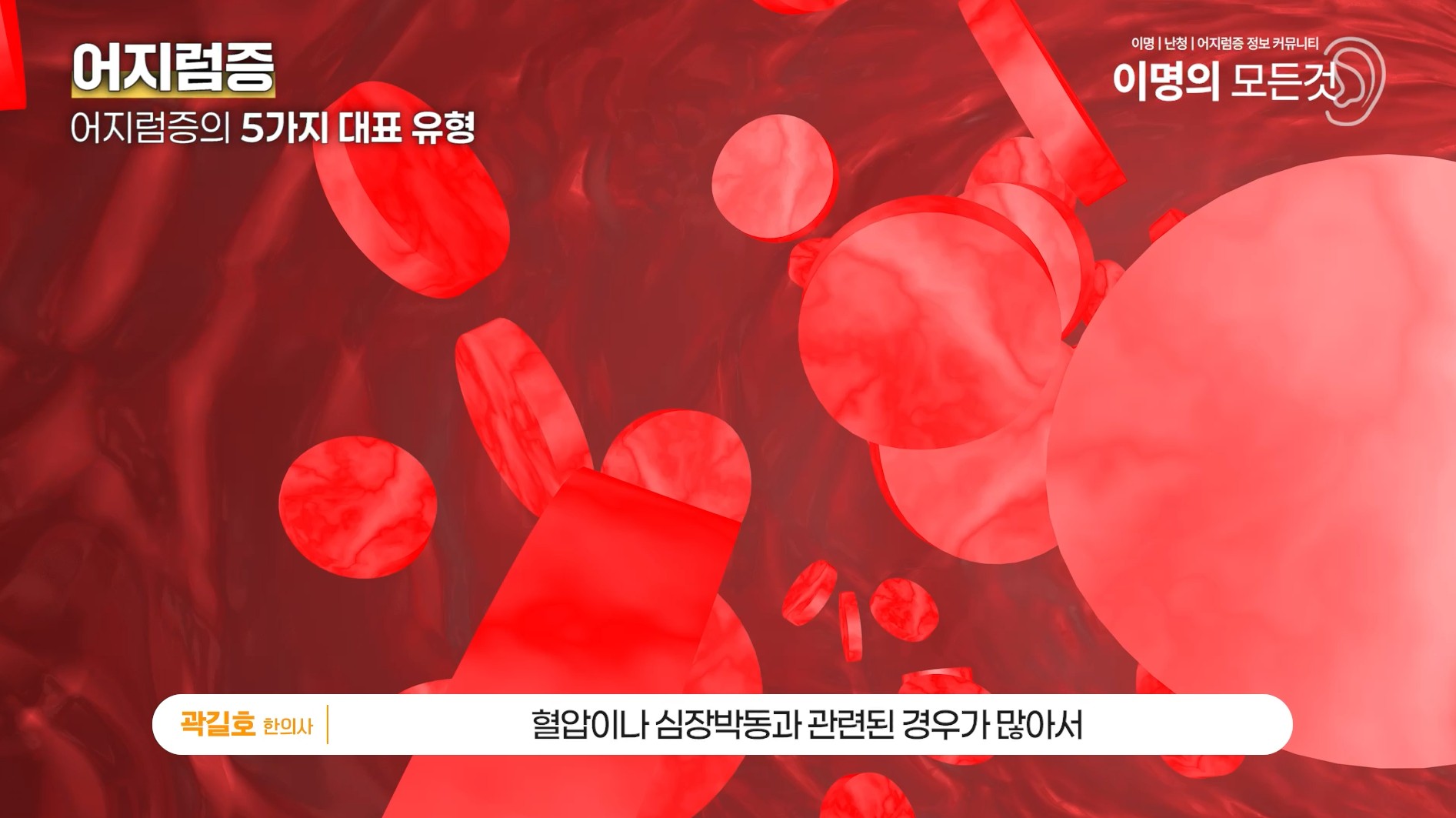 ④ 암흑발작형