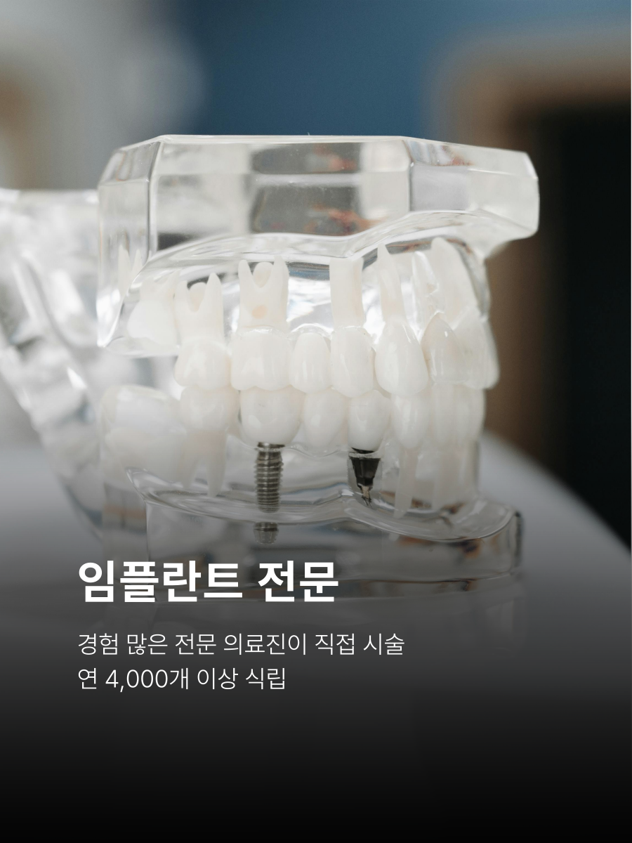 임플란트 치료 전문