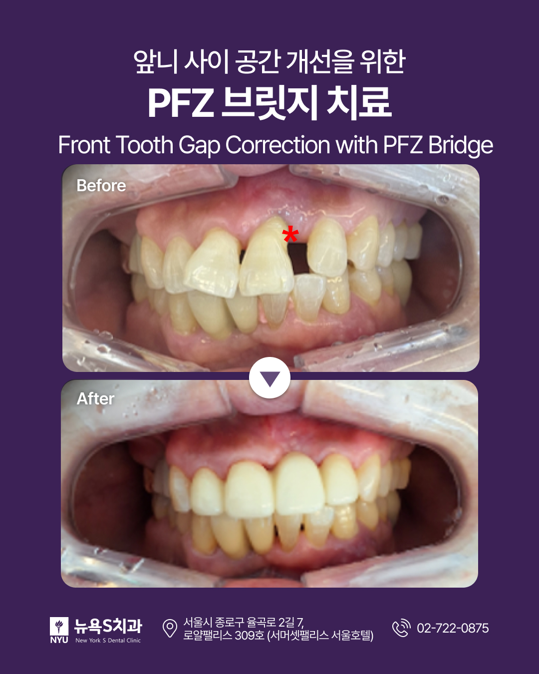 Dental care information from New York S Dental Clinic in Gwanghwamun