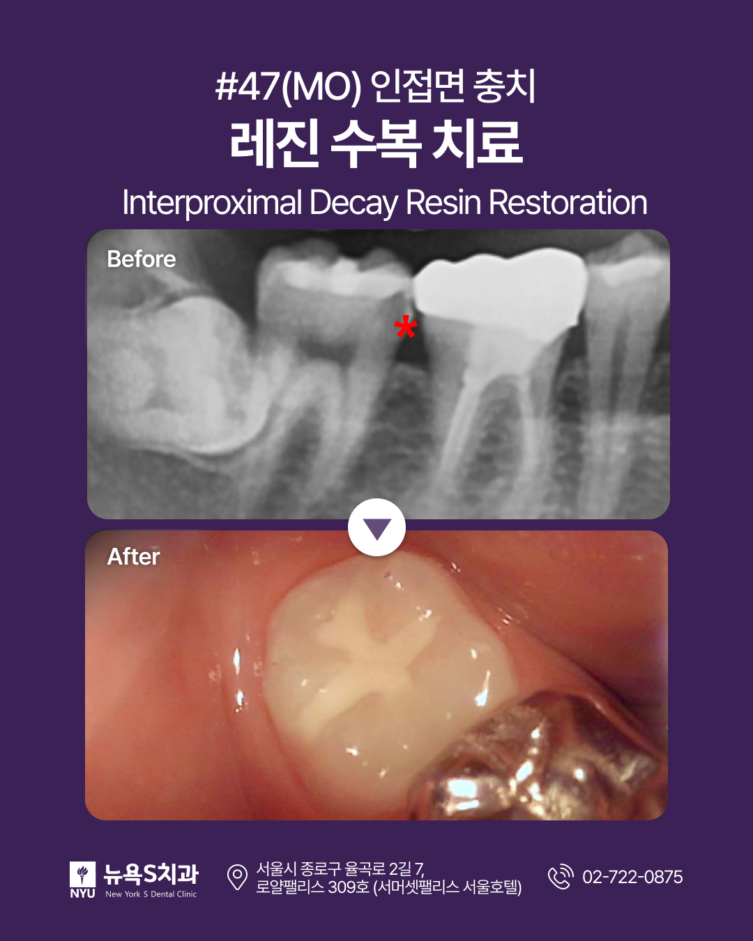 News and updates from New York S Dental Clinic