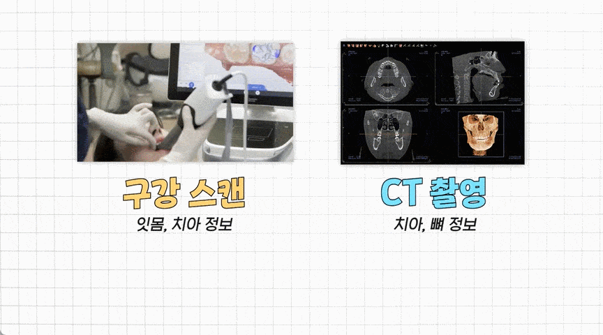 호평동_치과_09.gif