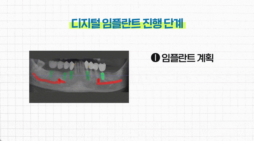 호평동_치과_04.gif