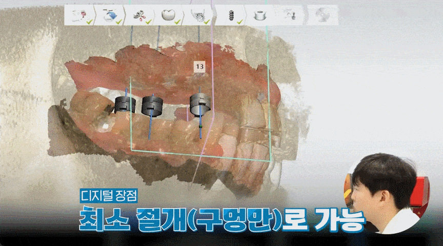 평내동치과 평내동임플란트