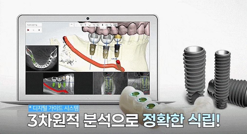 평내동치과 평내동임플란트