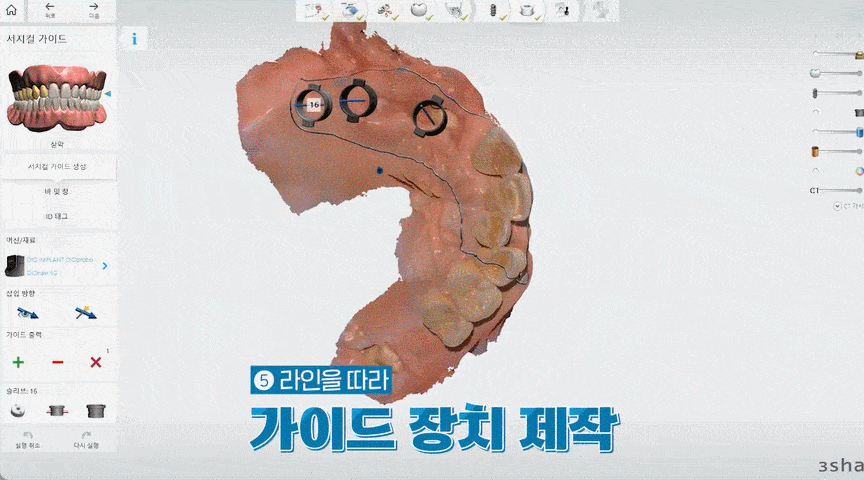 평내동치과 평내동임플란트