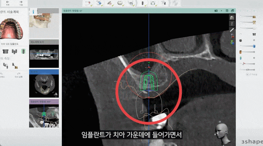 평내동치과 평내동임플란트