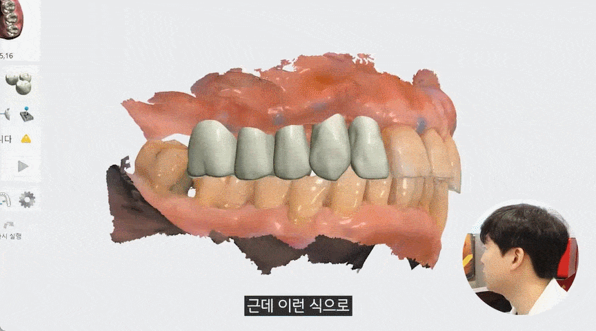 평내동치과 평내동임플란트
