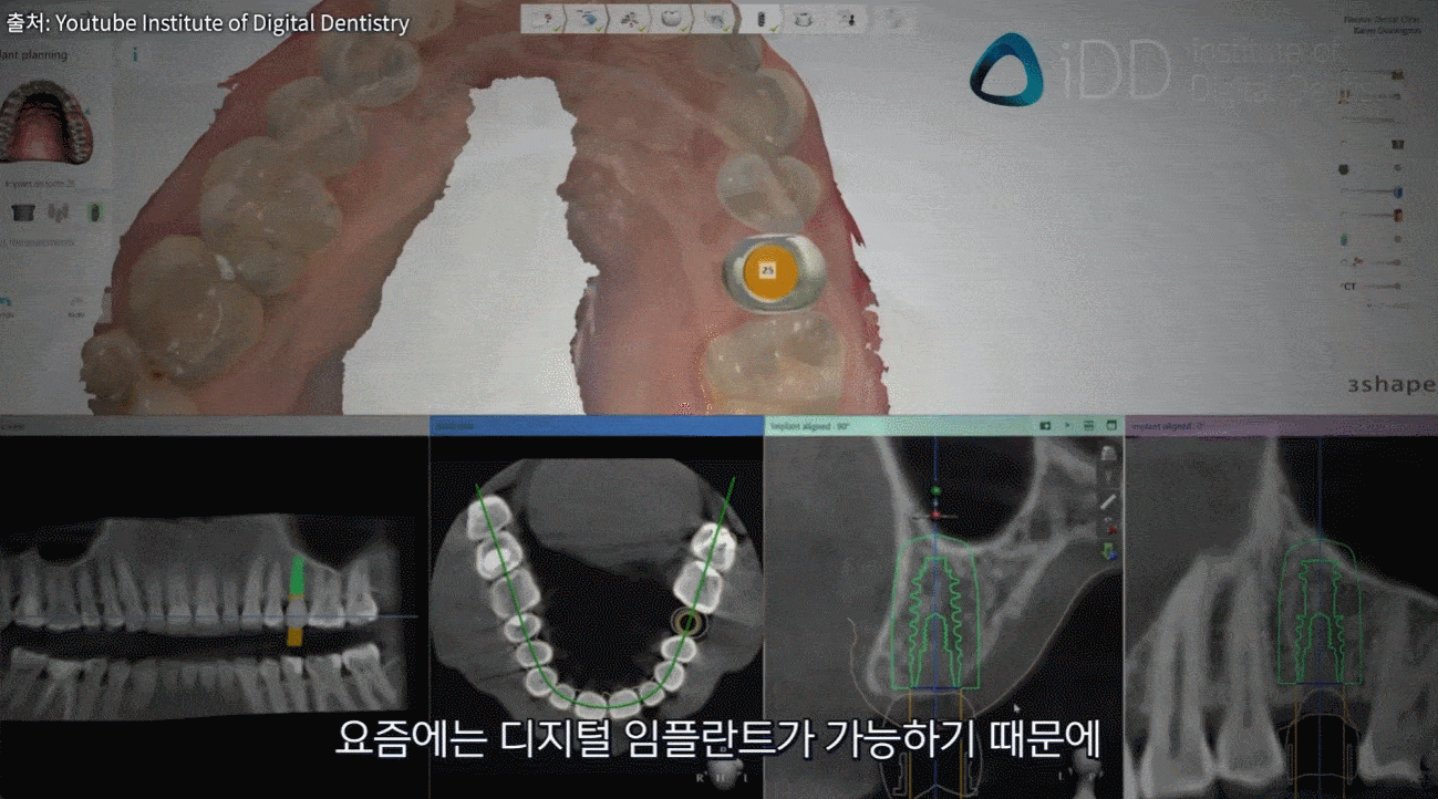 퇴계원_치과_11.gif