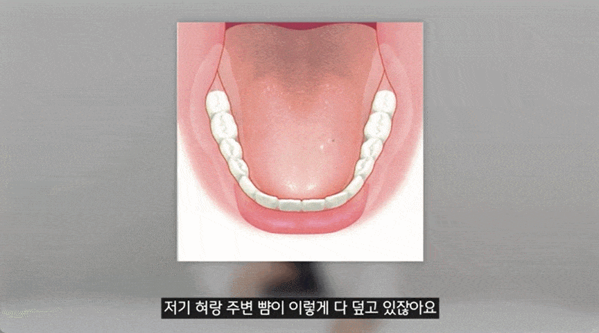 호평동_치과_04.gif
