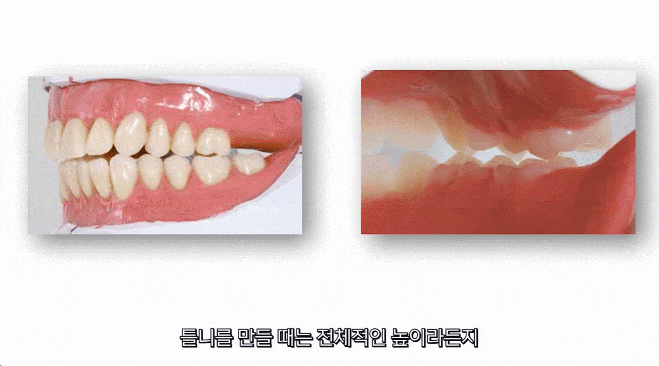 호평동_치과_08.gif