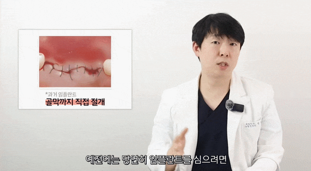 평내동치과 평내동임플란트