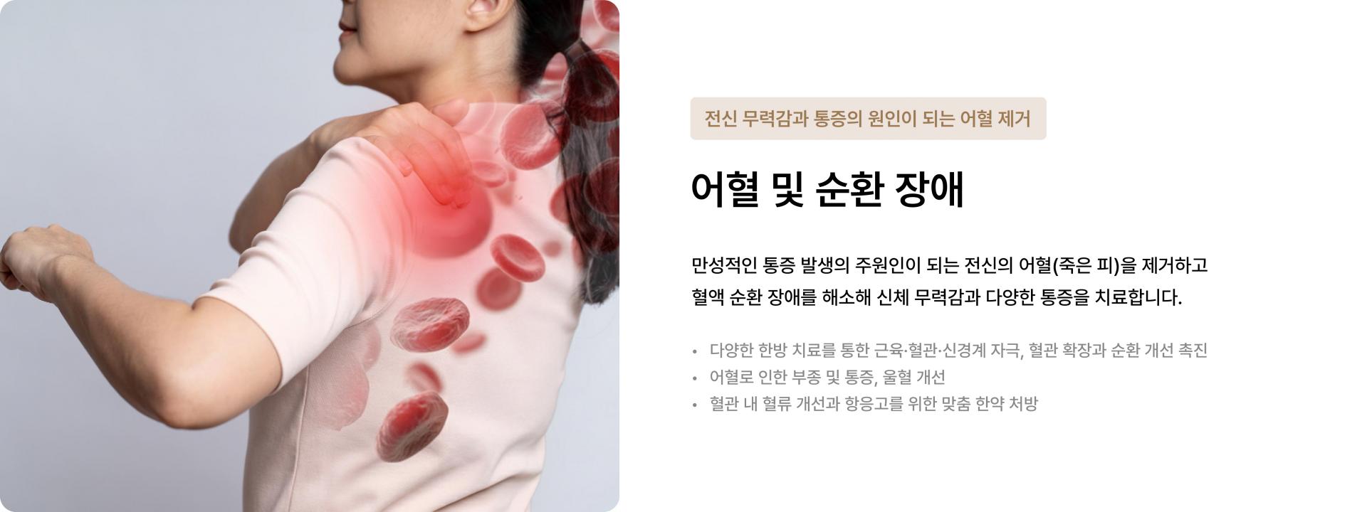 어혈 및 순환장애