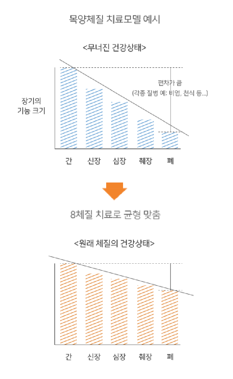 면역치료