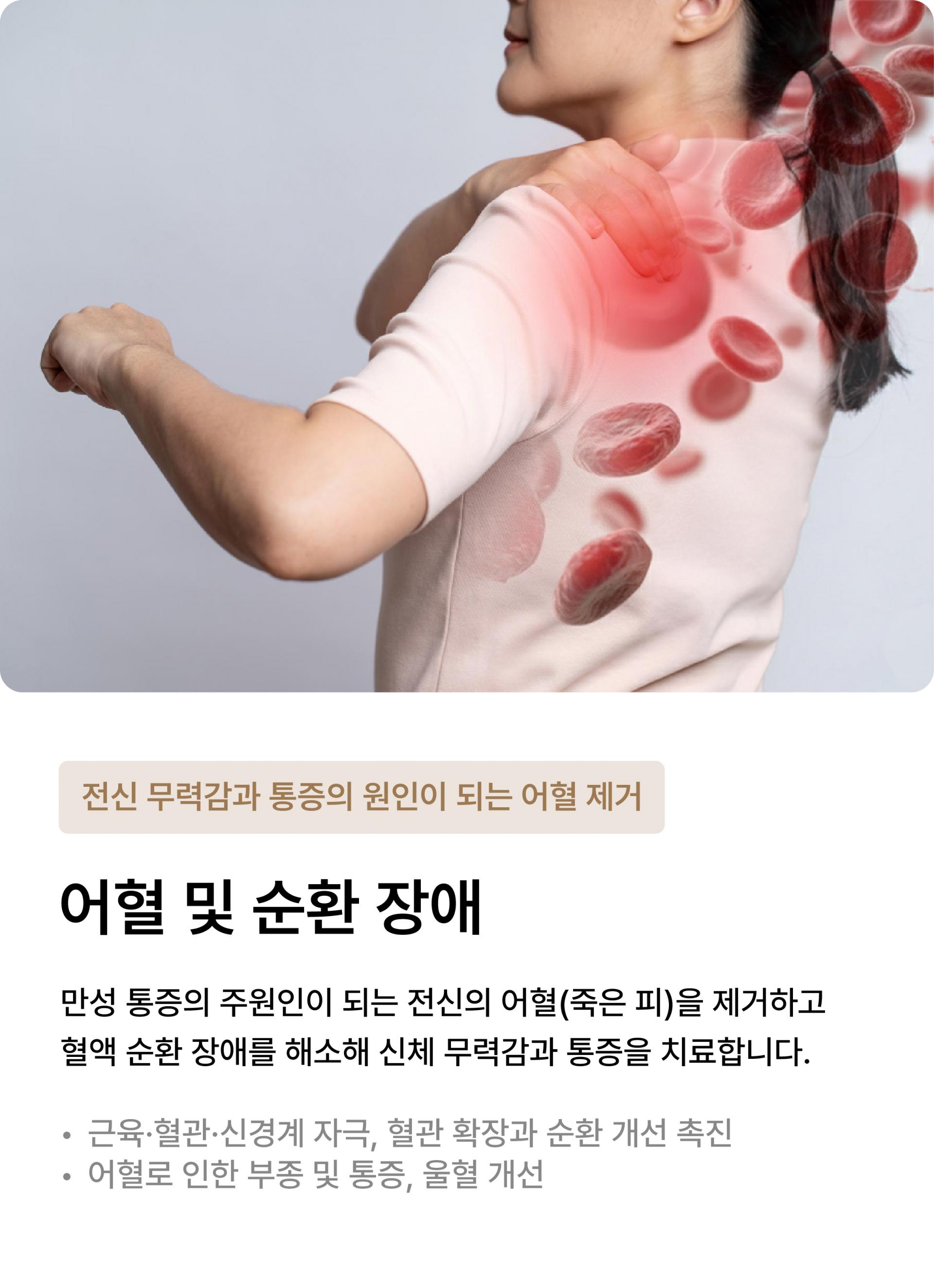 어혈