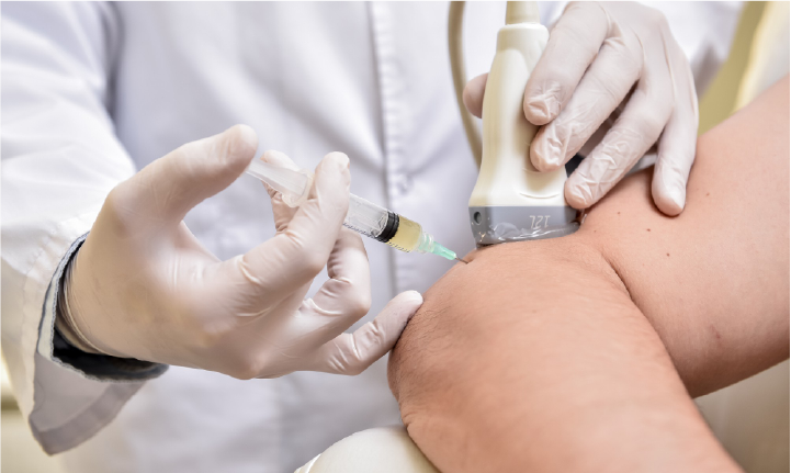 콜라겐 주사치료