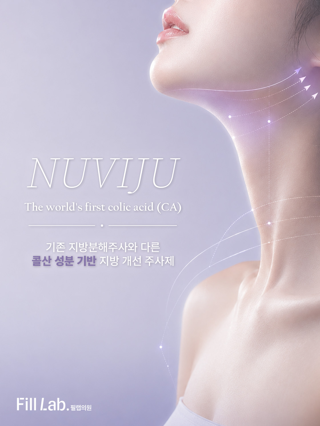 뉴비쥬