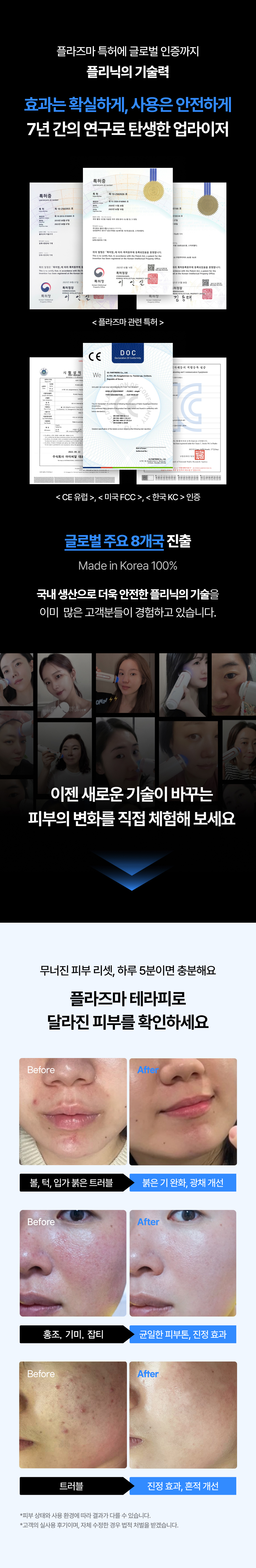 [슈퍼위크] 플리닉 업라이저 플라즈마 뷰티디바이스