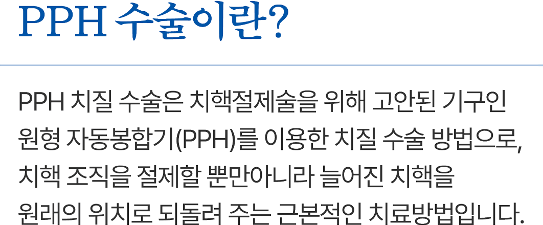 PPH 수술 설명