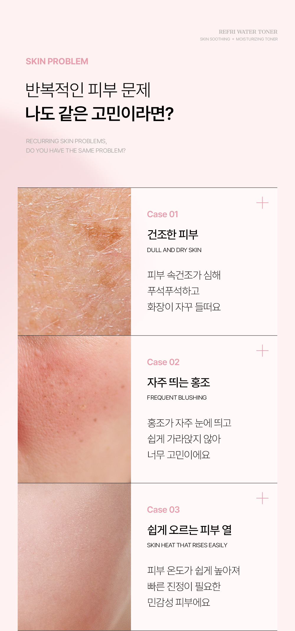 롸둥이들필수템 "꽁꽁팩❄&꽁꽁마스크팩🧊&백설기팩"