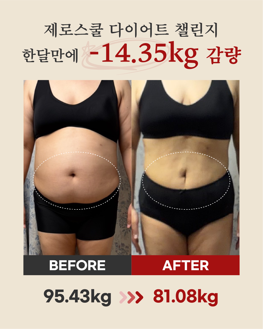리즈스쿨 한달관리 프로그램&리얼후기