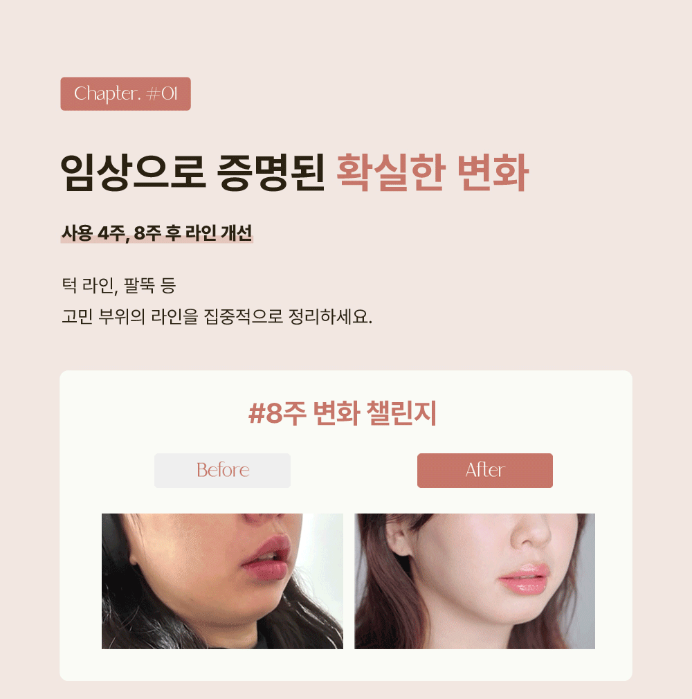 NEW 라라이프 윤곽세럼 & Zl흡크림