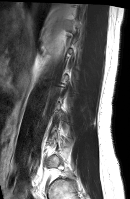 Real MRI