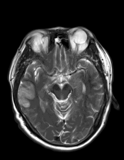 Real MRI