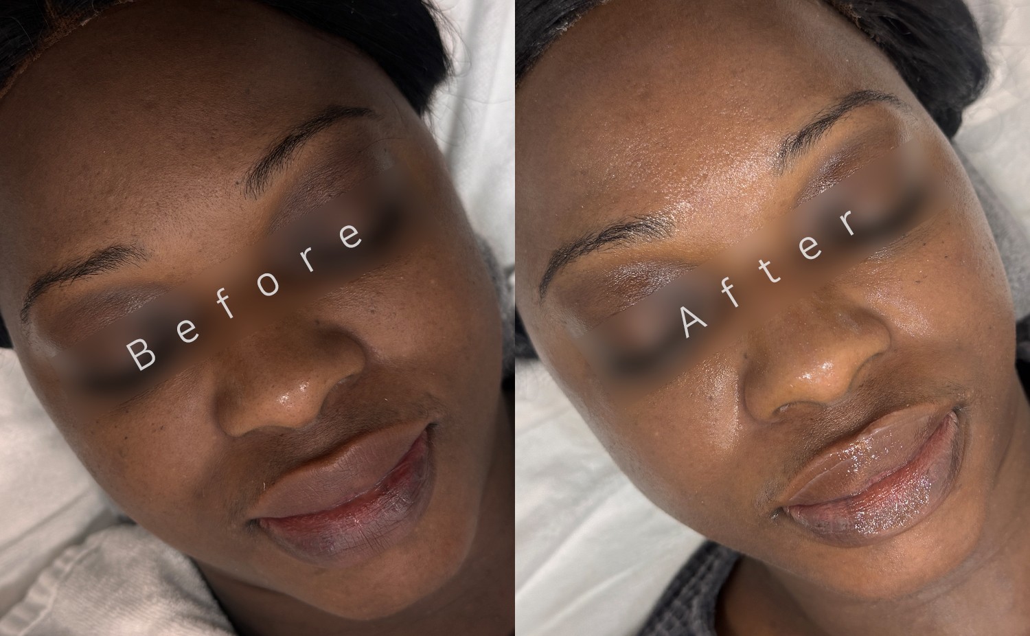 PDRN Glow Brightening Treatment