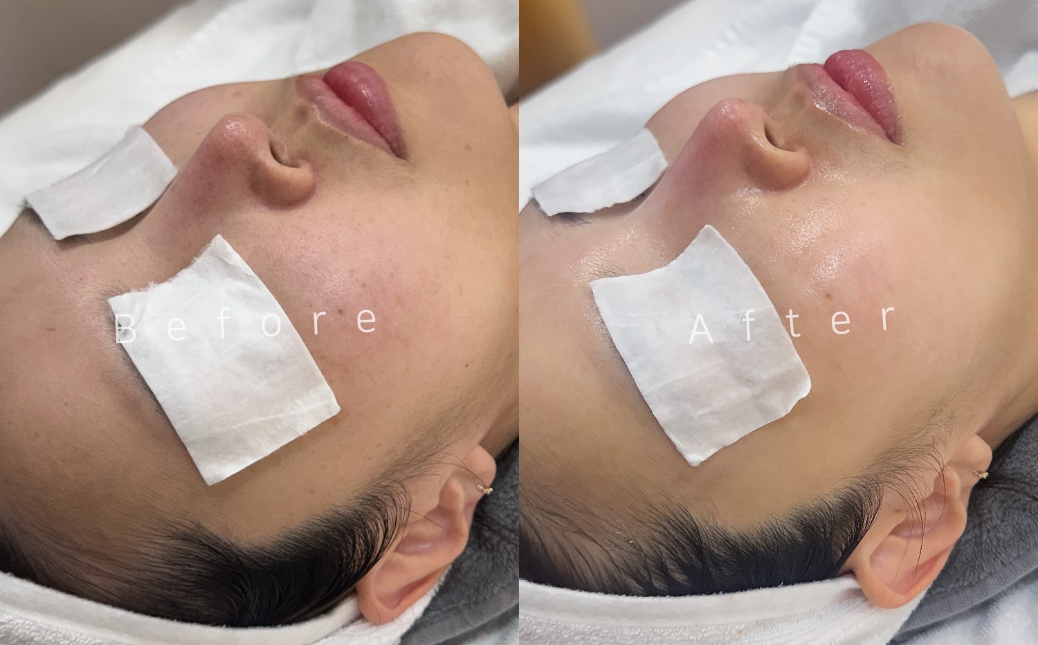 PDRN Glow Brightening Treatment
