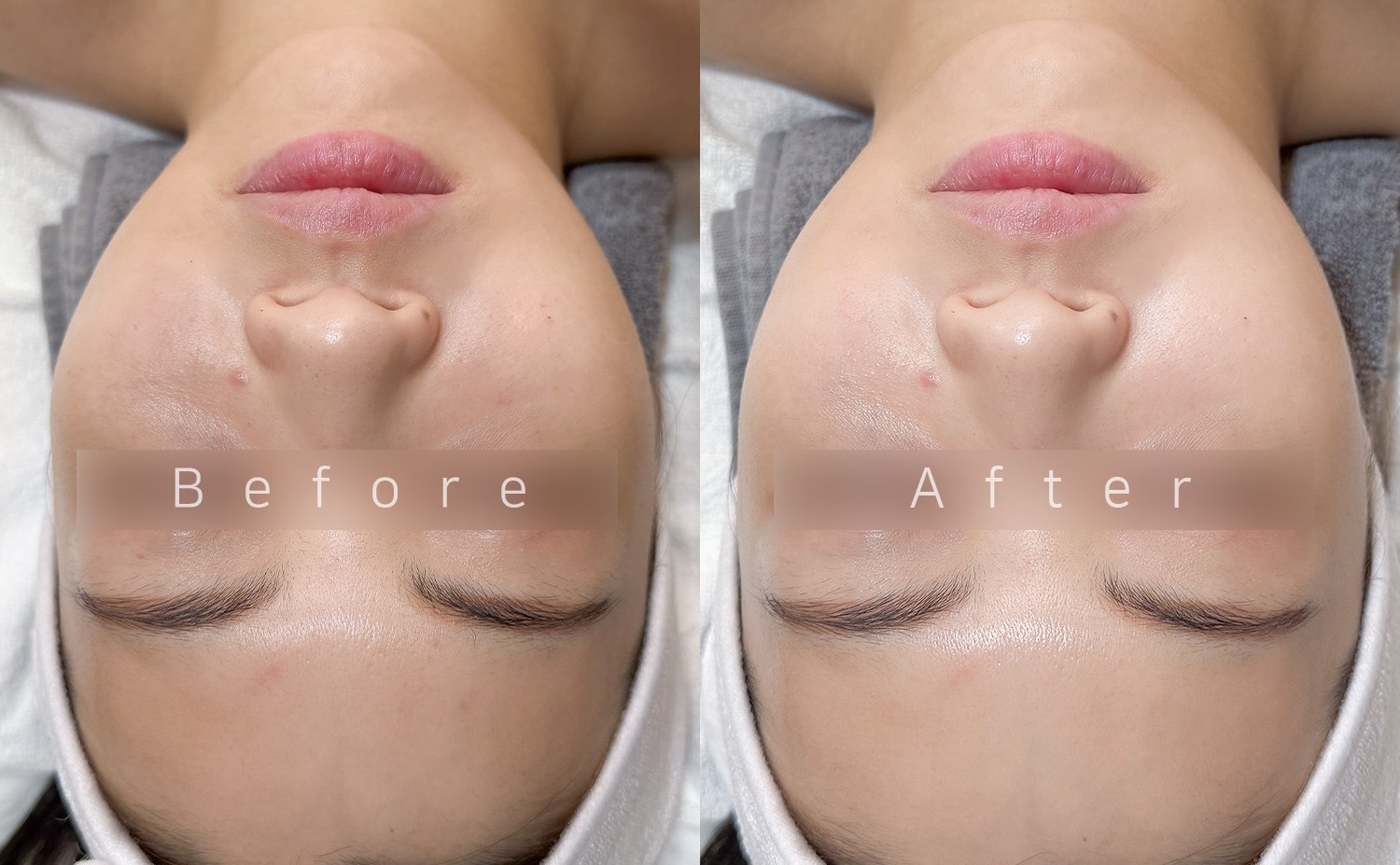 PDRN Glow Brightening Treatment