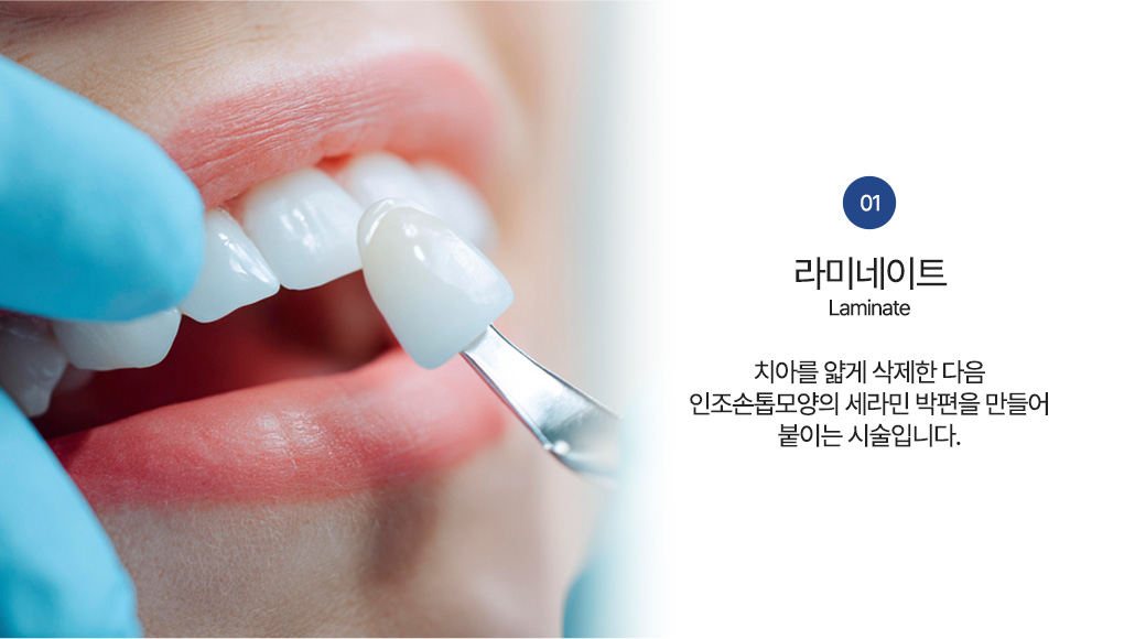 라미네이트