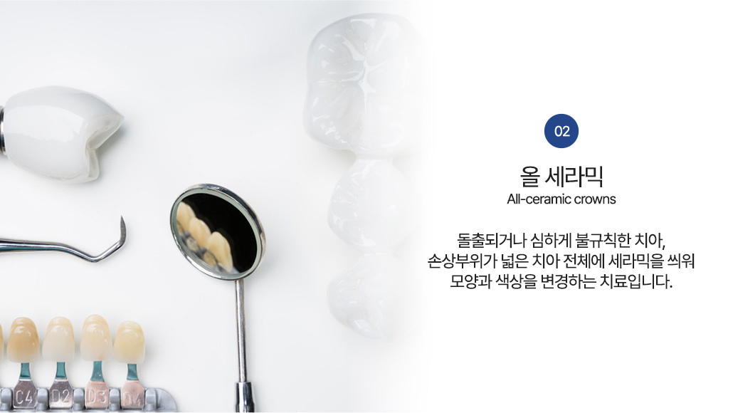 올 세라믹