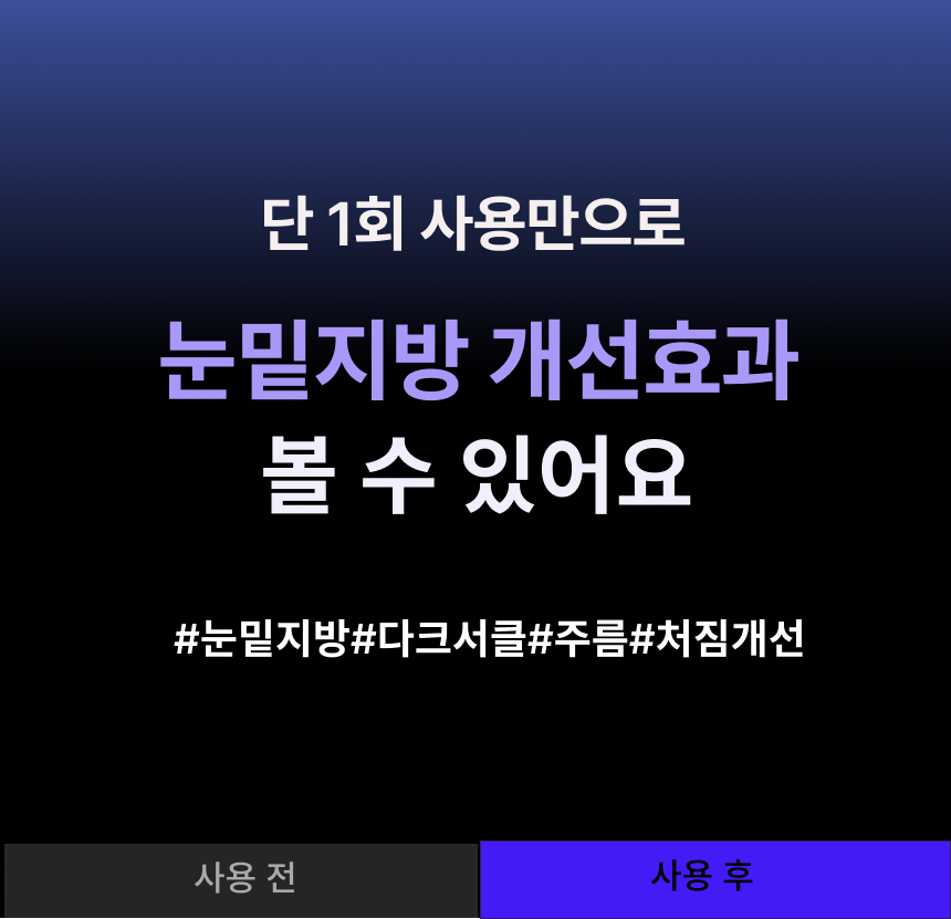 아이쎄놀 눈밑지방 레티놀 콜라겐 쿨링볼 30ml