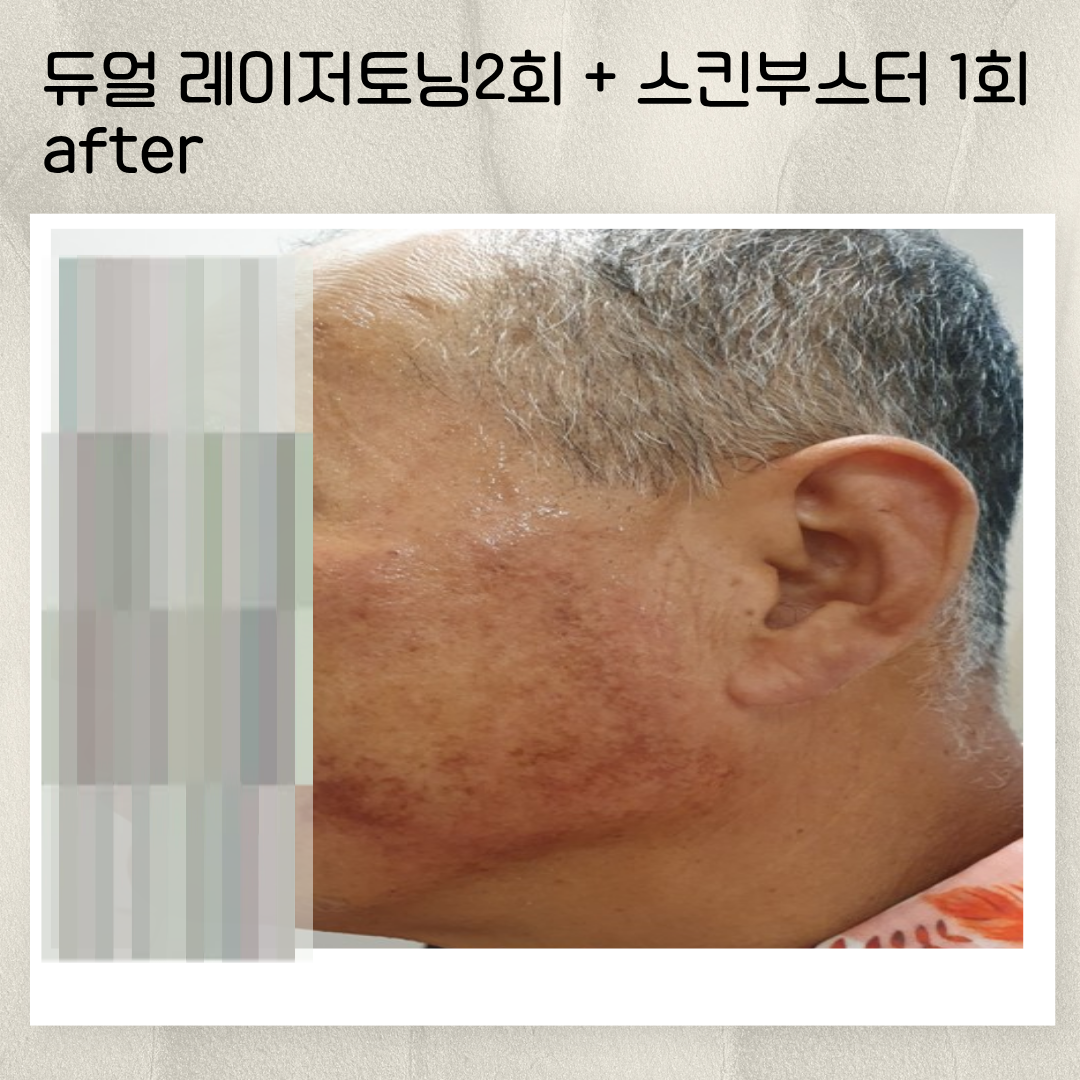 0d5abb2cb559e.png
