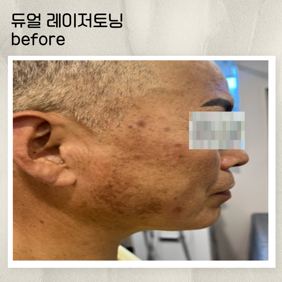 1dbcfc3789d60.png