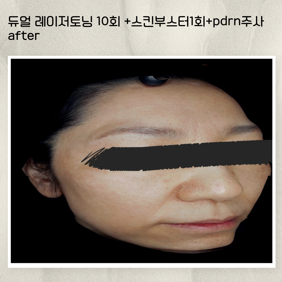 b64c2fa622f78.png